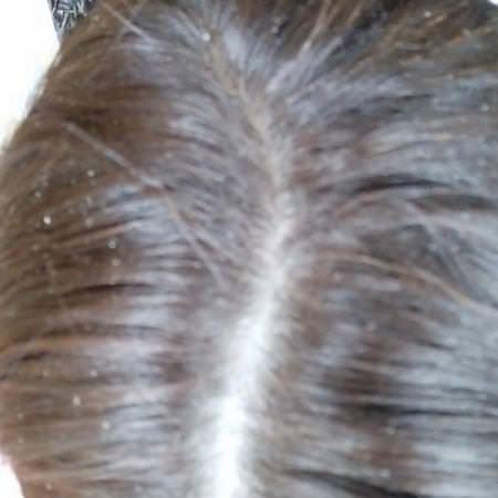 Avalon Organics Shampoo Hair Scalp Care - 頭皮護理, 頭髮, 洗髮水, 頭髮護理