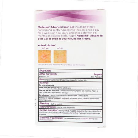 疤痕, 妊娠紋: Mederma, Advanced Scar Gel, 1.76 oz (50 g)