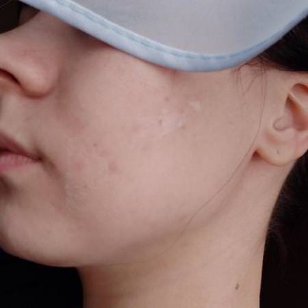 Neutrogena, Rapid Clear, Stubborn Acne, Daily Leave-On Mask, 2 oz (56 g)